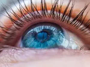 Close-up of scleral lens on eye cambridge, on